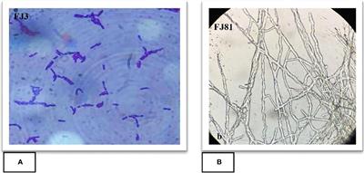 In vitro assessment of Bacillus subtilis FJ3 affirms its biocontrol and plant growth promoting potential